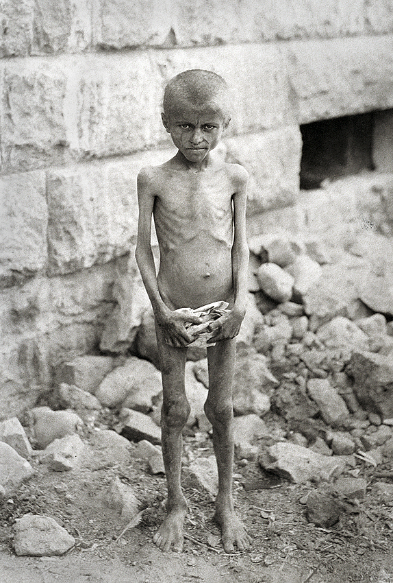 Harput 1915: uitgehongerde Armeense jongen zonder kleren